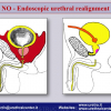 Diapositiva32