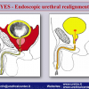 Diapositiva36