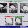 Diapositiva08