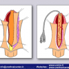 Diapositiva24