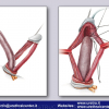 Diapositiva33