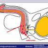 Diapositiva69