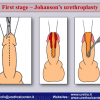 Diapositiva30