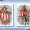 Diapositiva18