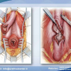 Diapositiva31