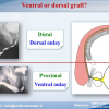 Diapositiva08