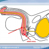 Diapositiva17