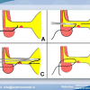 Diapositiva27