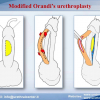 Diapositiva31