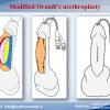 Diapositiva32