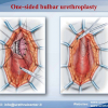 Diapositiva46