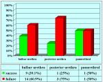 stent-endouretrale-en-11