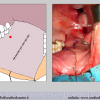 Diapositiva12