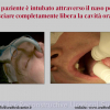 Diapositiva10