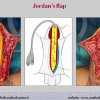 Diapositiva09