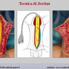 Diapositiva09